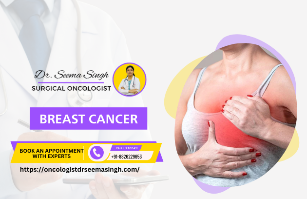 expert surgical oncologist in ghaziabad