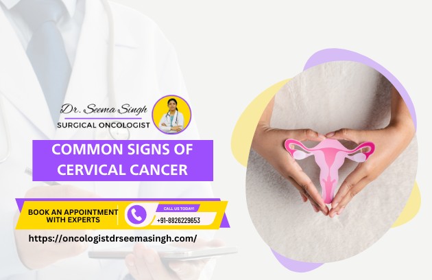 cervical cancer specialist