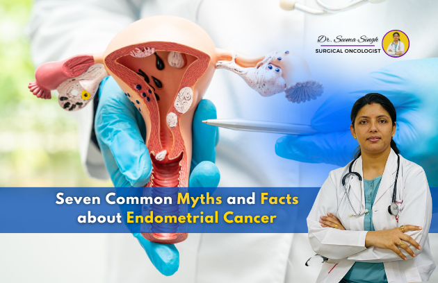 Endometrial Cancer Debunking Seven Common Myths And Facts