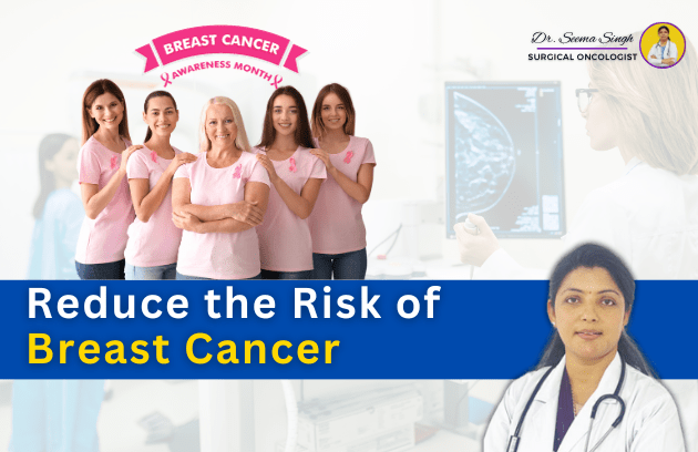 breast cancer doctor near ghaziabad