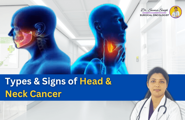 head and neck cancer doctor in ghaziabad
