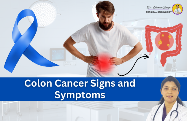 colon cancer doctor in ghaziabad