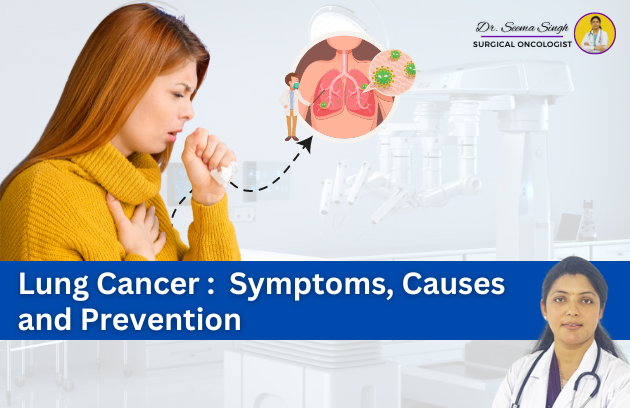 Lung cancer doctor in ghaziabad